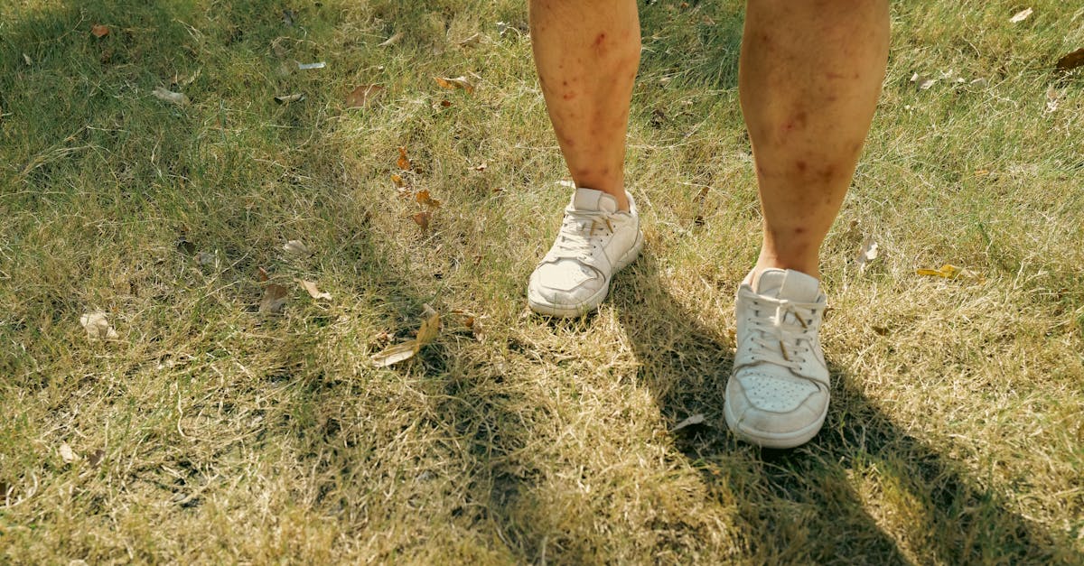 learn about brachial plexus injuries, their causes, symptoms, and treatment options. discover how these injuries affect arm movement and function, and explore resources for recovery and rehabilitation.