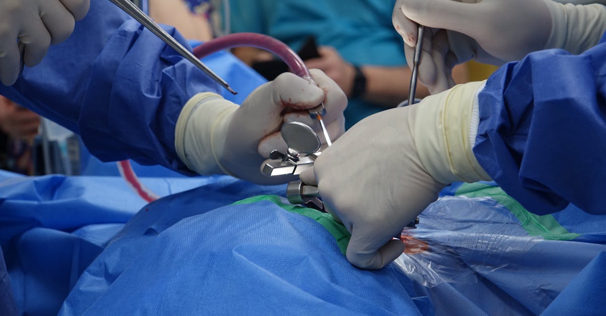 discover the causes, symptoms, and treatment options for a herniated disc. learn how to manage pain and improve mobility with expert insights and effective strategies.