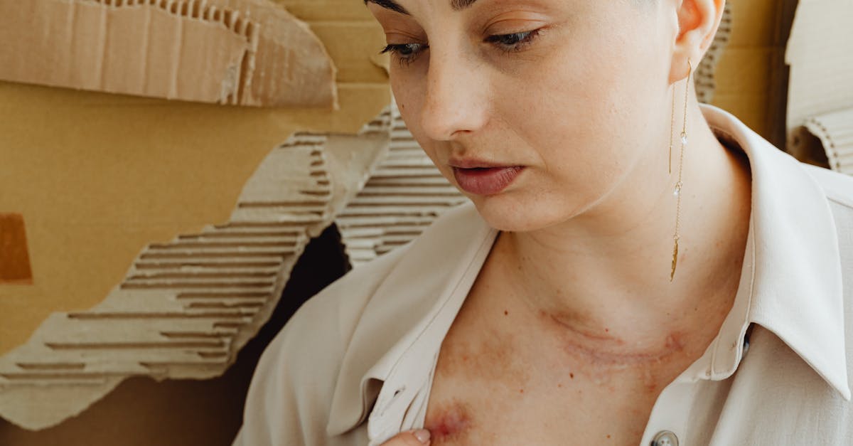discover effective treatments and tips to relieve shoulder pain. understand the causes, symptoms, and preventive measures for a healthier, pain-free life.
