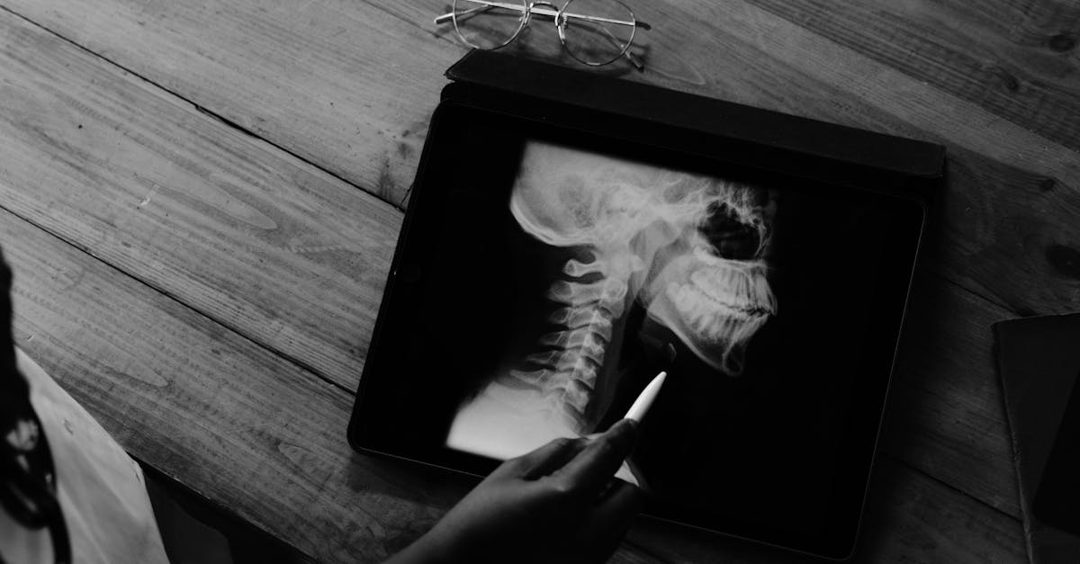 discover effective strategies to alleviate tech neck discomfort caused by prolonged device use. learn about prevention techniques, exercises, and ergonomics to maintain a healthy posture in the digital age.