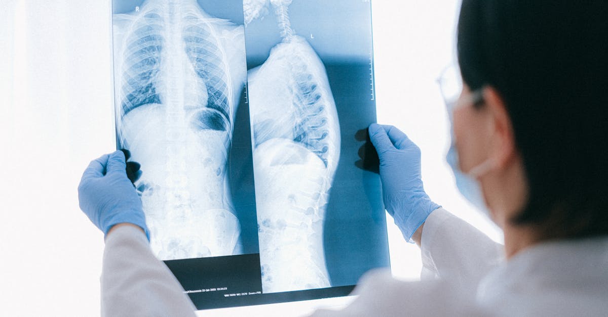 discover effective insights and solutions for managing thoracic spine pain. learn about causes, symptoms, and treatment options to alleviate discomfort and improve your quality of life.