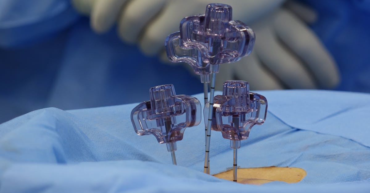 Avantages spécifiques
