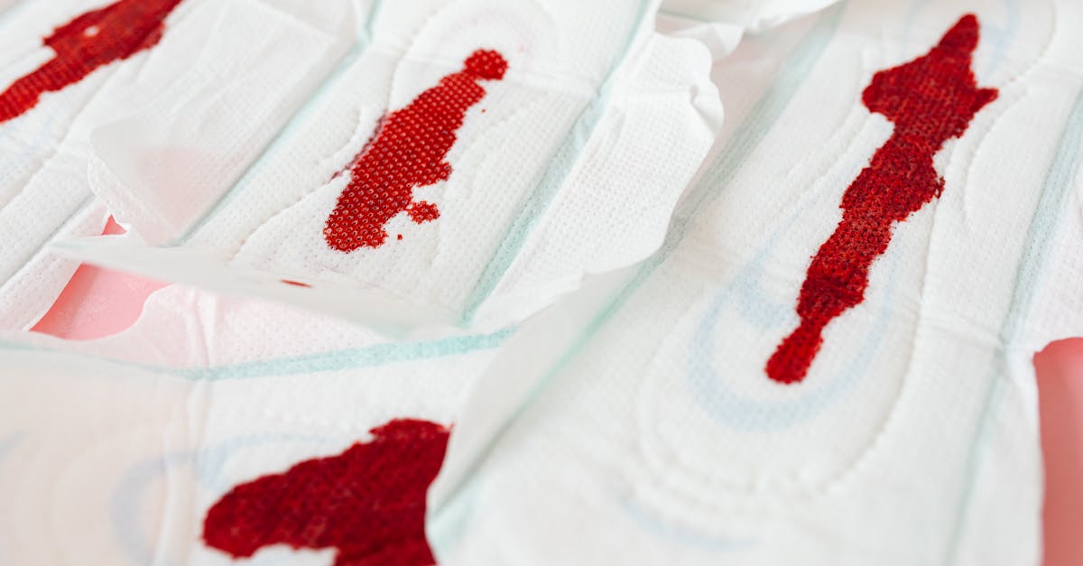 discover effective strategies and insights to manage menstrual migraines, a common issue impacting many women. learn about triggers, treatments, and lifestyle changes that can help alleviate discomfort during your menstrual cycle.