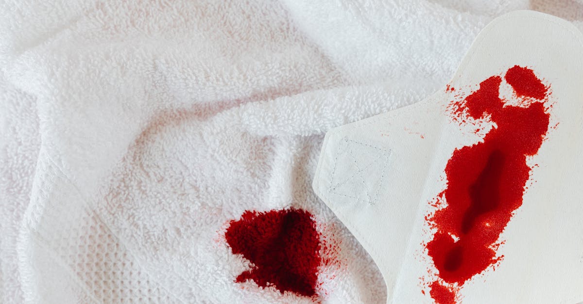 discover effective strategies to manage and relieve menstrual migraines. learn about the connection between hormonal fluctuations and migraine symptoms, and explore tips for prevention and treatment to regain control during your menstrual cycle.