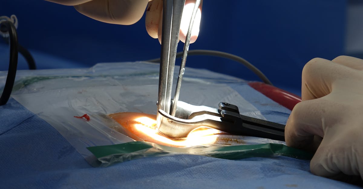 discover the causes, symptoms, and treatment options for spinal stenosis. learn how this condition affects the spine and explore effective management strategies to alleviate pain and improve mobility.