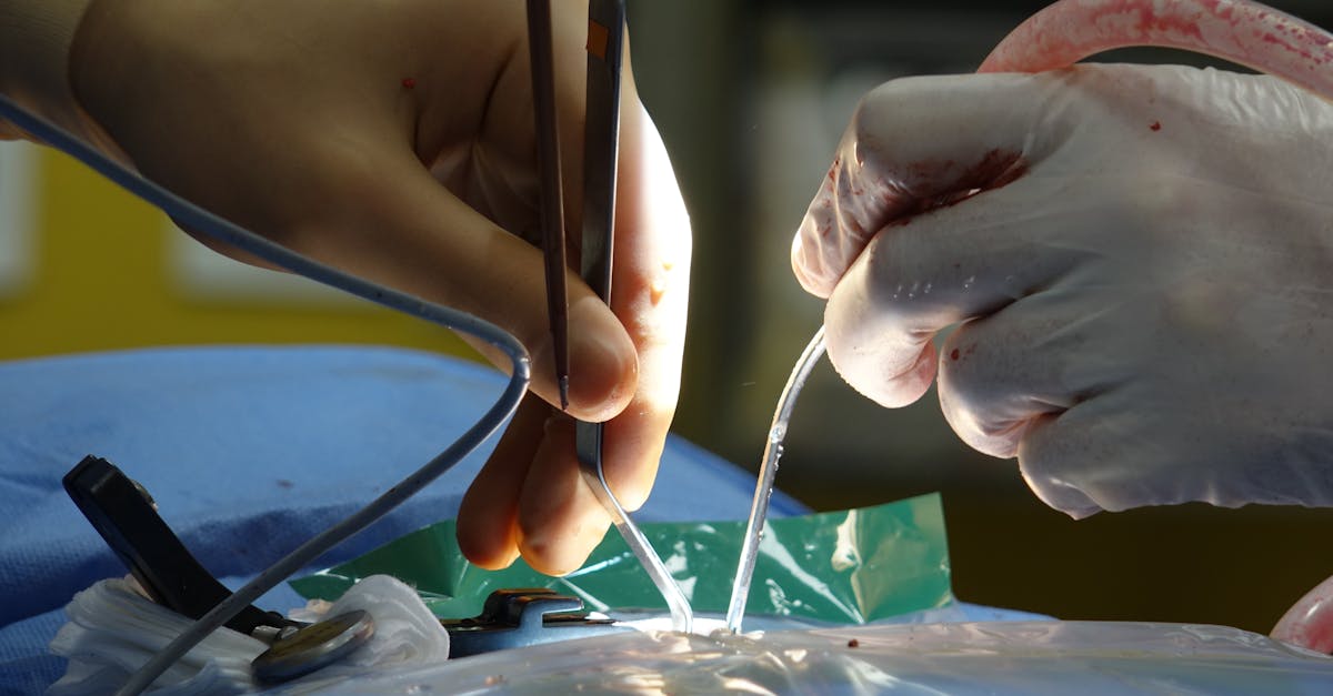 discover the causes, symptoms, and treatment options for a herniated disc. learn how this common spinal condition can affect your health and mobility, and explore effective strategies for relief and recovery.