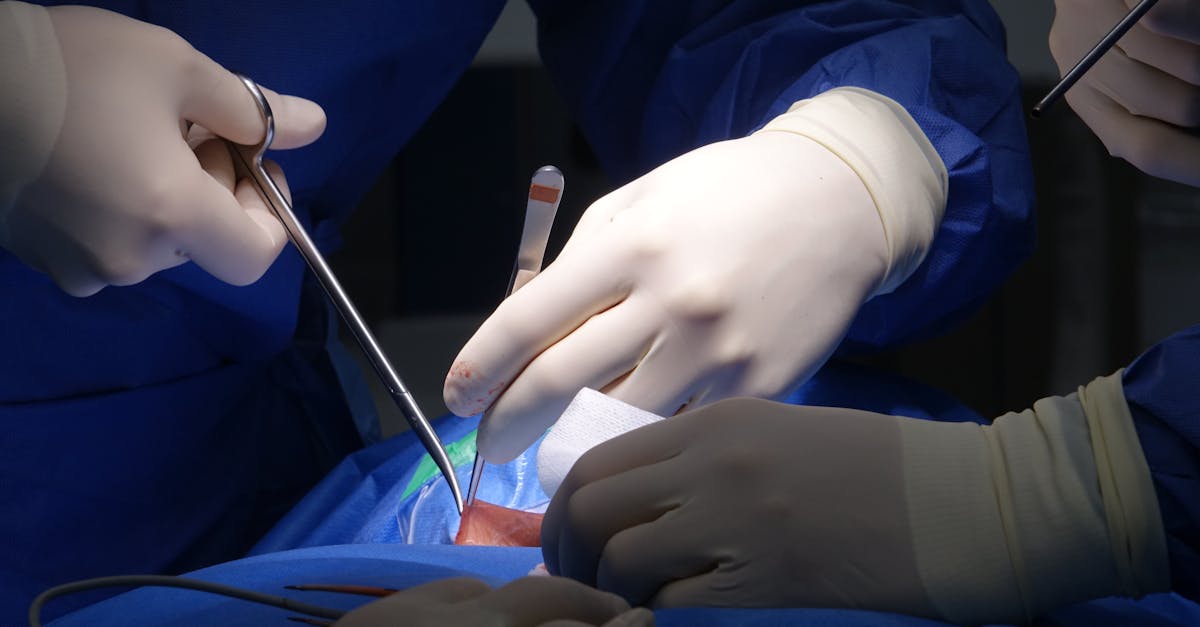 discover comprehensive insights into spinal stenosis, its causes, symptoms, and effective treatment options to alleviate pain and improve mobility. learn how to manage this condition and enhance your quality of life.